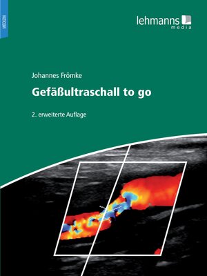 cover image of Gefäßultraschall to go